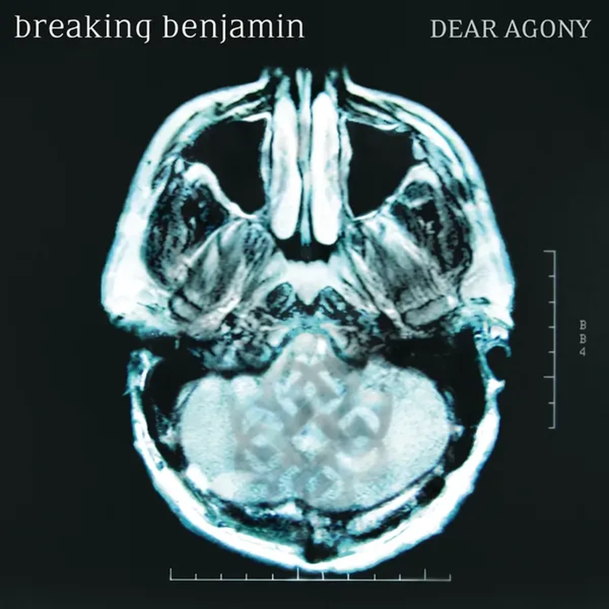 Dear Agony